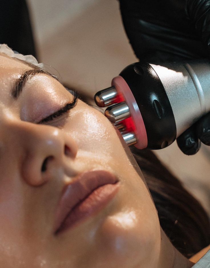Radiofrecuencia Facial